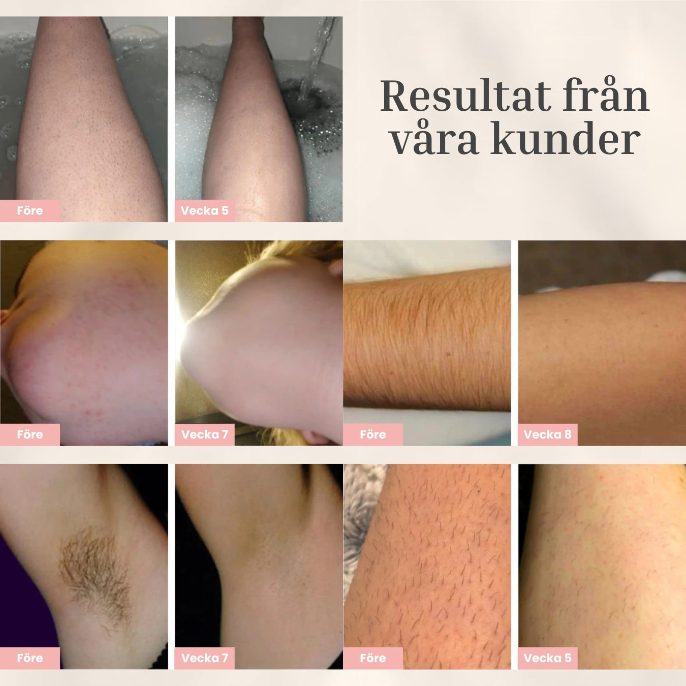 Luvièn IPL Laser - Permanent Laser Hårfjerner